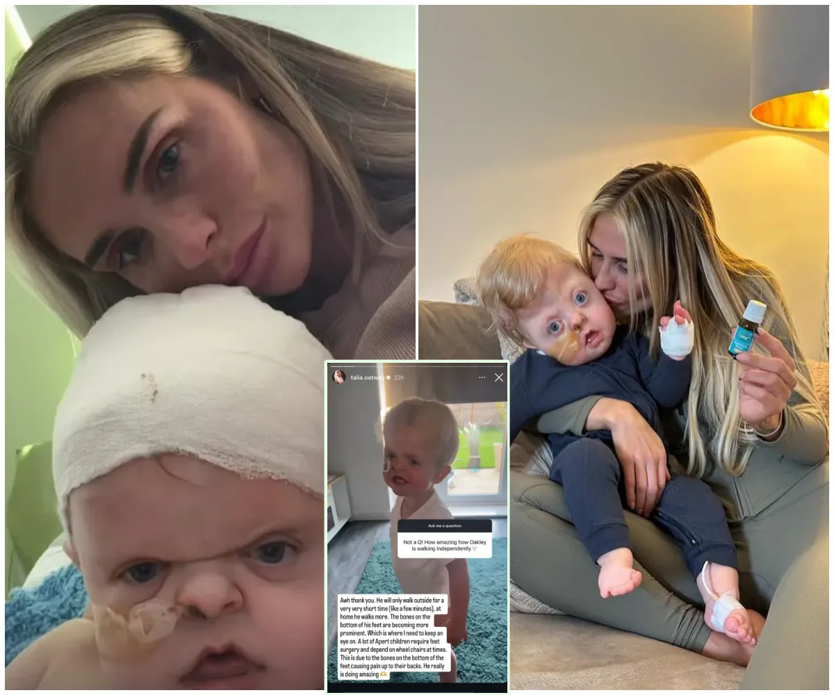 “I cry a lot” — Geordie Shore’s Aaron Chalmers’ ex Talia Oatway reveals their son Oakley may one day need a wheelchair as she shares emotional update on his heartbreaking Apert Syndrome battle - suong