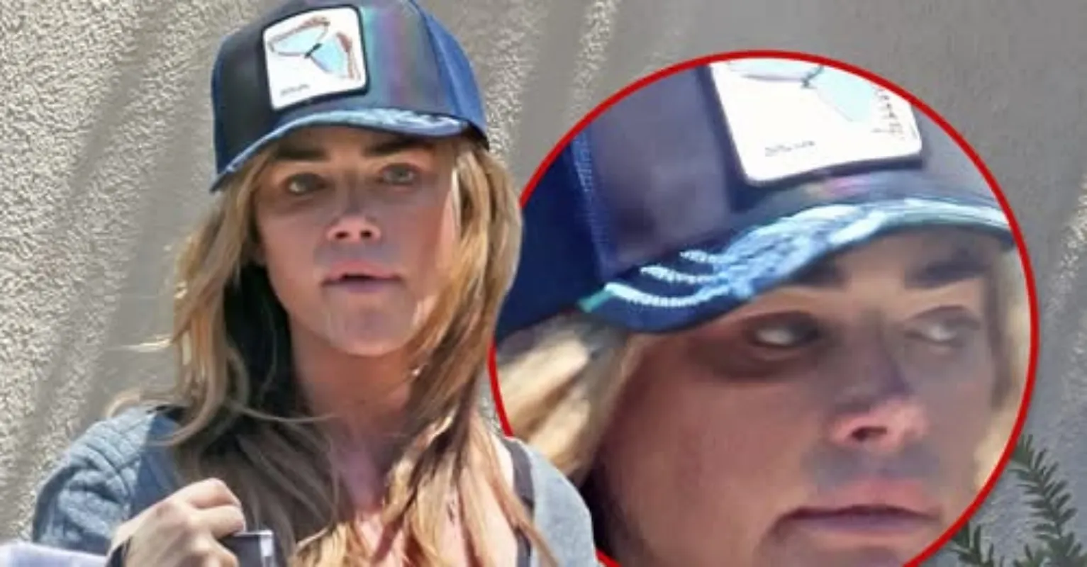Denise Richards That's Not Eyeshadow ... Steps Out With Apparent Shiner