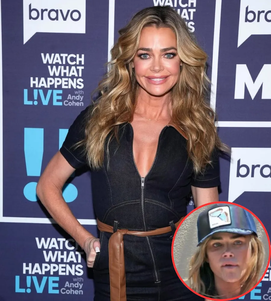 Denise Richards Spotted with Black Eye After Police Incident at Aaron Phypers' Home