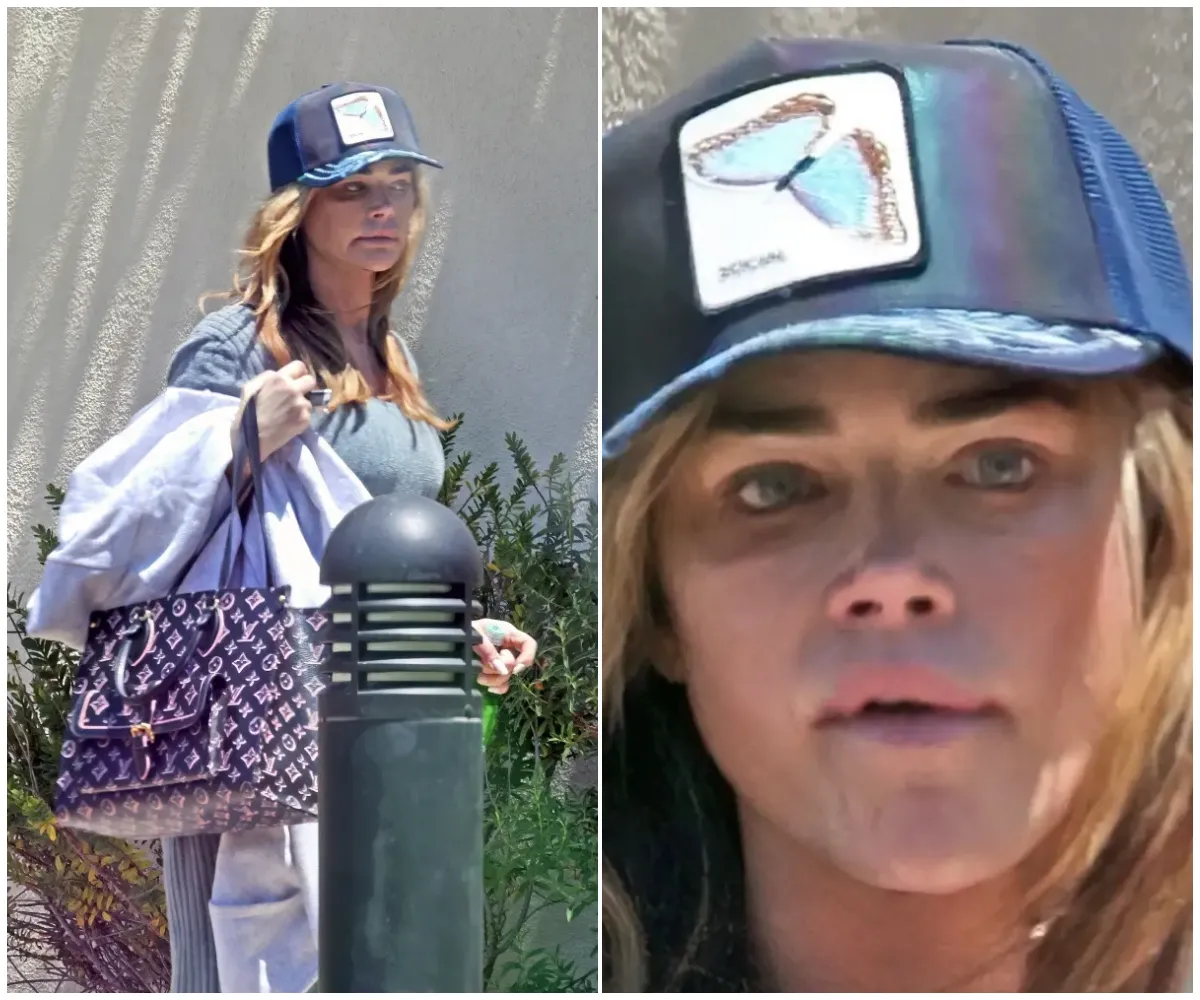 Denise Richards spotted with apparent black eye just days after estranged husband Aaron Phypers called cops on her — amid explosive abuse claims, restraining order, and bitter divorce battle - suong