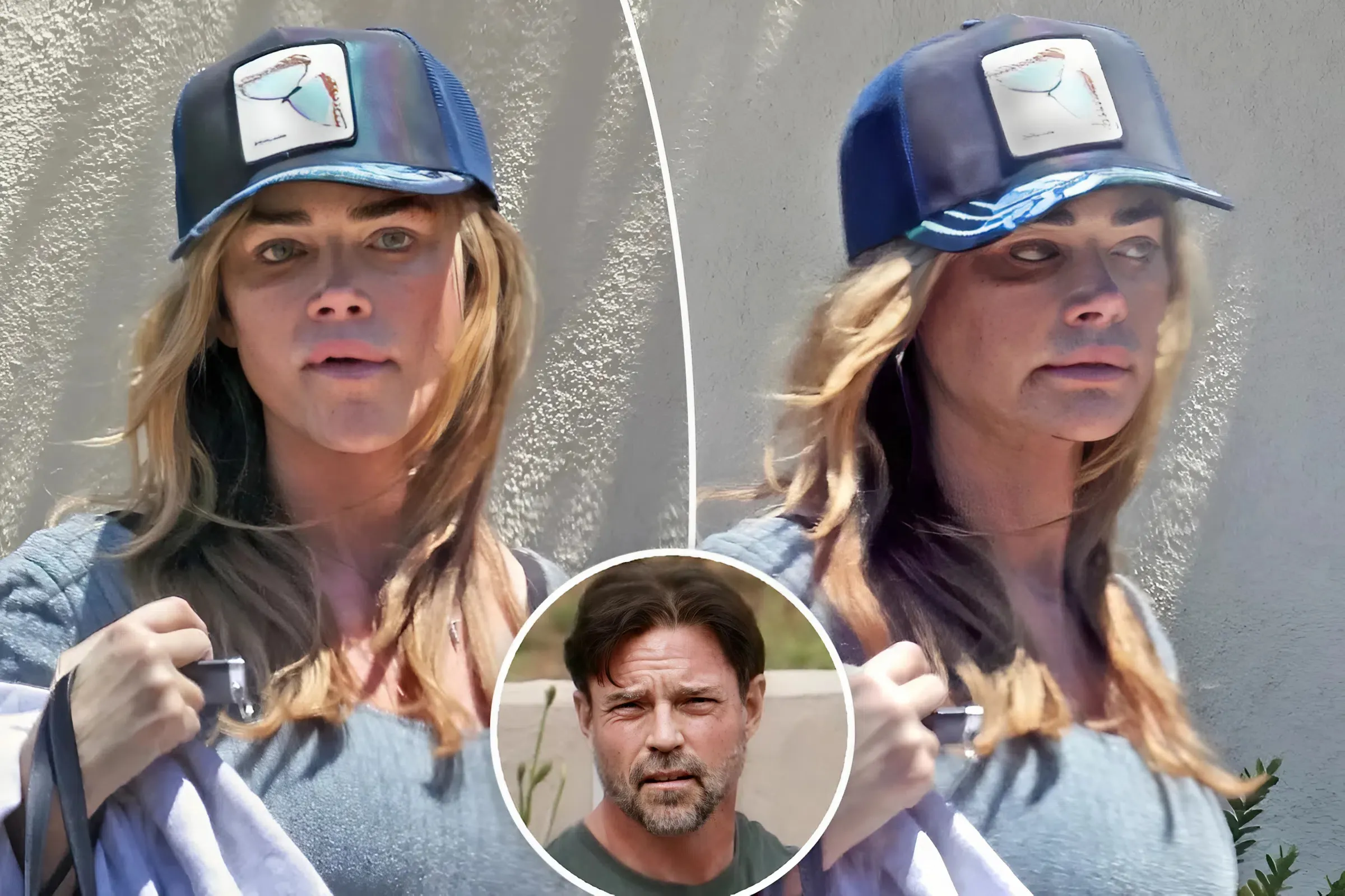 Denise Richards seen with black eye days after estranged husband Aaron Phypers called cops