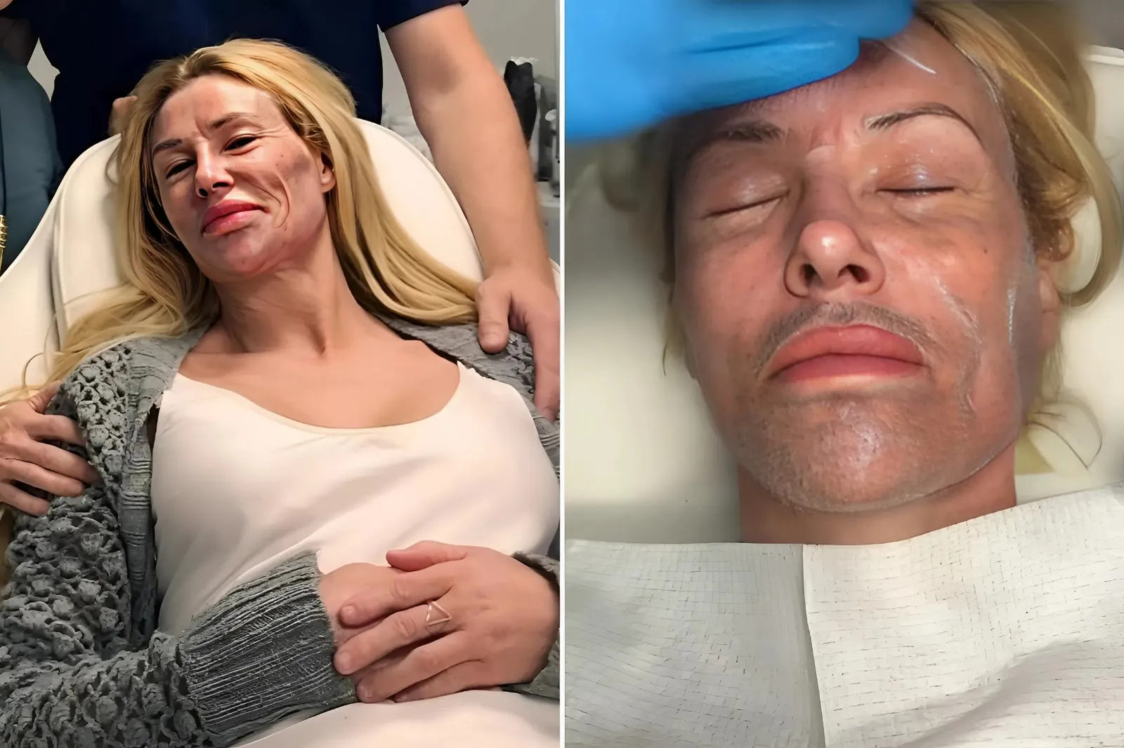 Brandi Glanville Speaks Out: “I’m Scarred, Not Broken” Amid 2-Year Mystery Illness and Public Cruelty