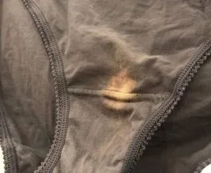 PP2. If You Find a "Bleach" Patch on Your Underwear, Here’s What It Means
