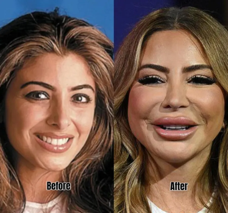 PHOTOS: RHOM’s Larsa Pippen Shocks Fans With “Different Face” as Surgeon Weighs in on ‘Fuller’ Look