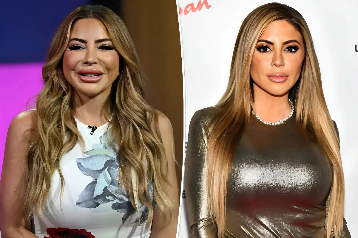 Larsa Pippen blames ‘allergic reaction’ for her shocking face transformation tram