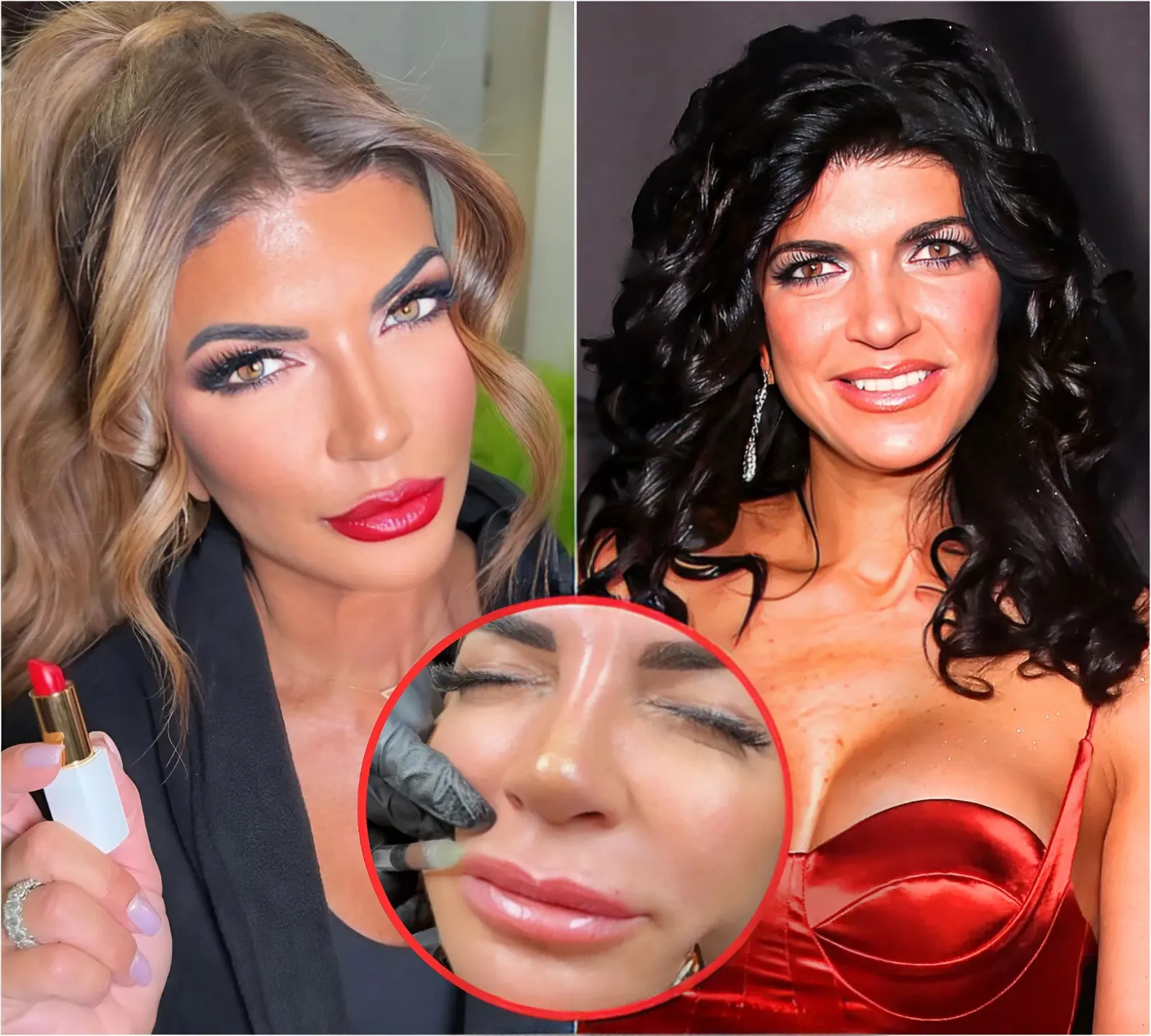RHONJ’s Teresa Giudice is Called Out for “Too Much Fillers” and FaceTune as Fans Beg Her to Go Back to a More Natural Look