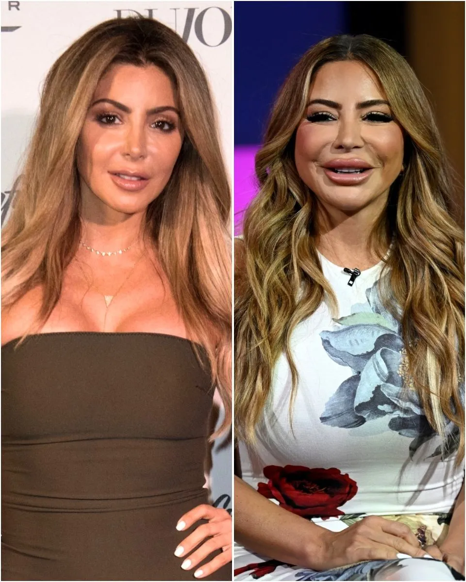 RHOM’s Larsa Pippen Blames “Allergic Reaction” for Swollen Face After Being Accused of “Filler Gone Wrong” as She Shares Procedure She Had