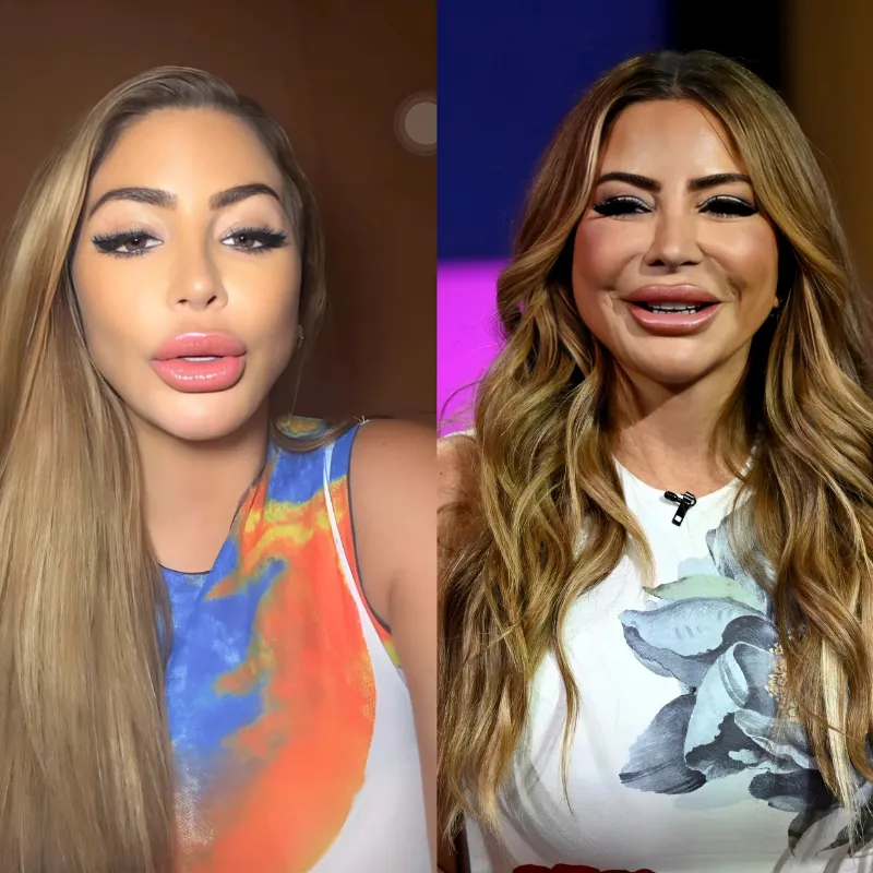 RHOM Star Larsa Pippen Suggests Viral Photo of Her Was Altered as Dr. Jen Armstrong Denies Her Claim That Allergic Reaction Caused Facial Swelling-quang