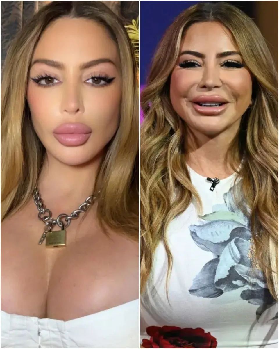 Larsa Pippen doubles down on allergic reaction claims after photo of ‘overfilled’ face went viral: ‘Keep on hating’