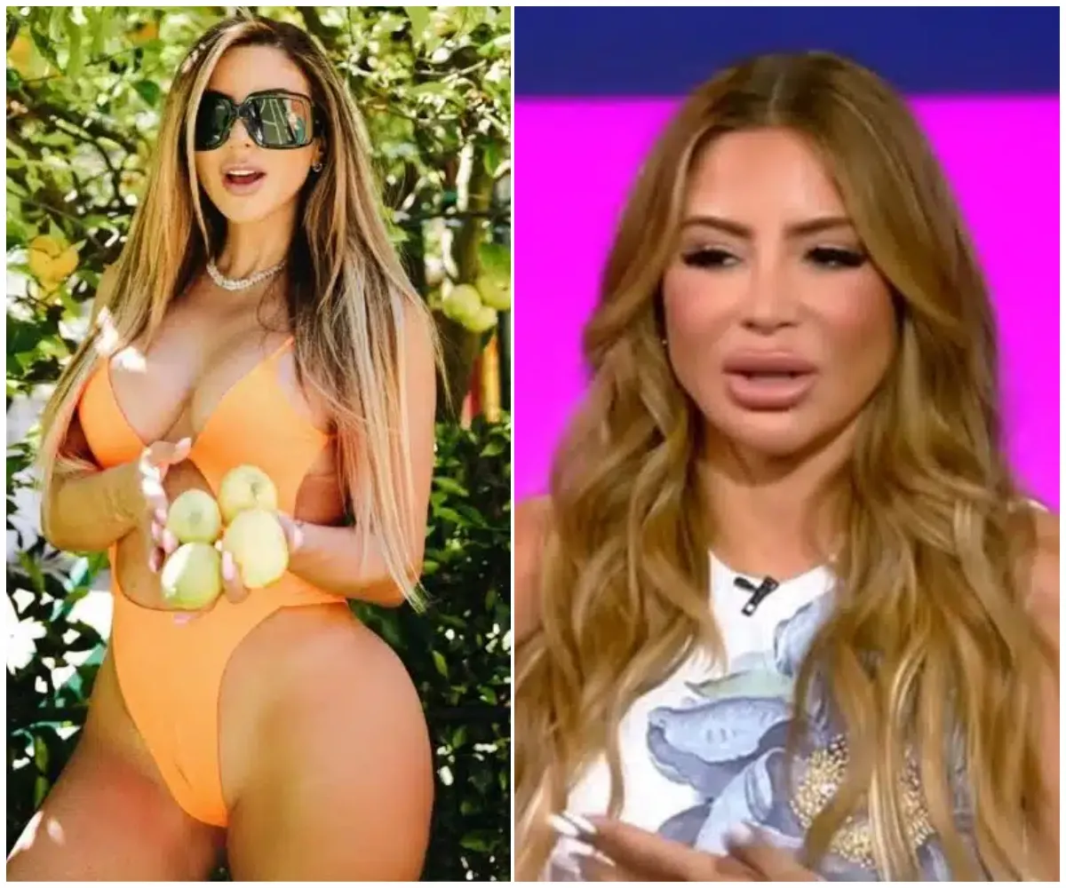 ‘It’s not filler!’ — Larsa Pippen claps back at critics, claiming allergic reaction to PRP landed her in the ER amid trolling over her ‘swollen’ face - suong