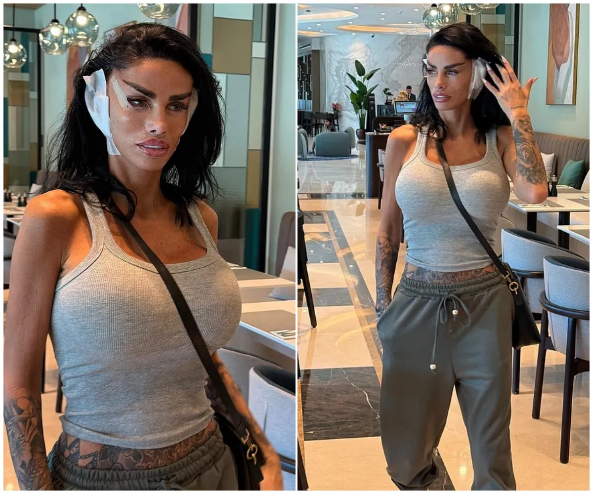 ‘Bloodied, bandaged… and back for more’ — Katie Price, 47, steps out in Turkey after yet ANOTHER tweak to her SIXTH facelift, flaunting post-op look in tight vest just days after daughter Princess, 18, pointedly vowed she’d ‘never’ ...- suong