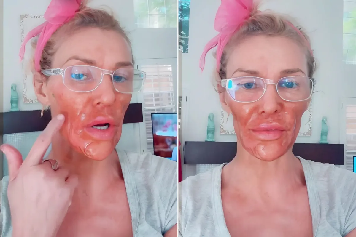 Unveiling Brandi Glanville's Facial Transformation: The Shocking Disfiguration and the Desperate 'Beauty Hack' She Experimented With - lulu