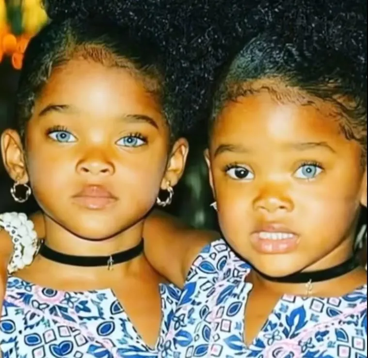13 Years Ago They Were Called The World’s Most Beautiful Twins – Now Look At Them