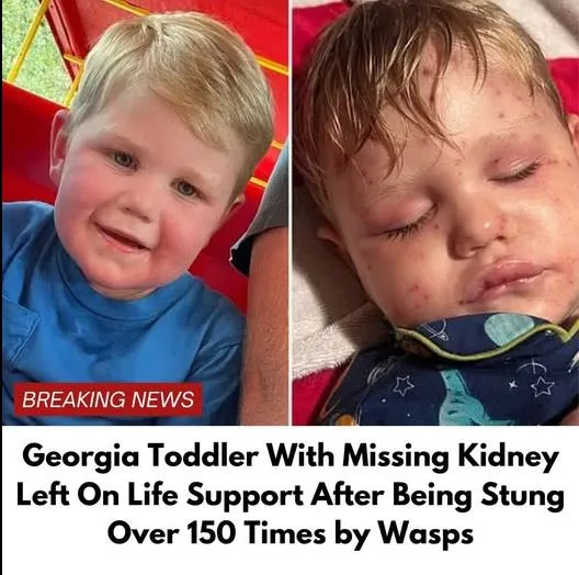 Georgia toddler stung over 150 times by yellow jackets, fighting for life