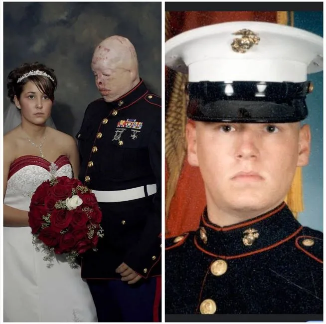 Tyler Ziegel returned from Iraq with wounds that never healed