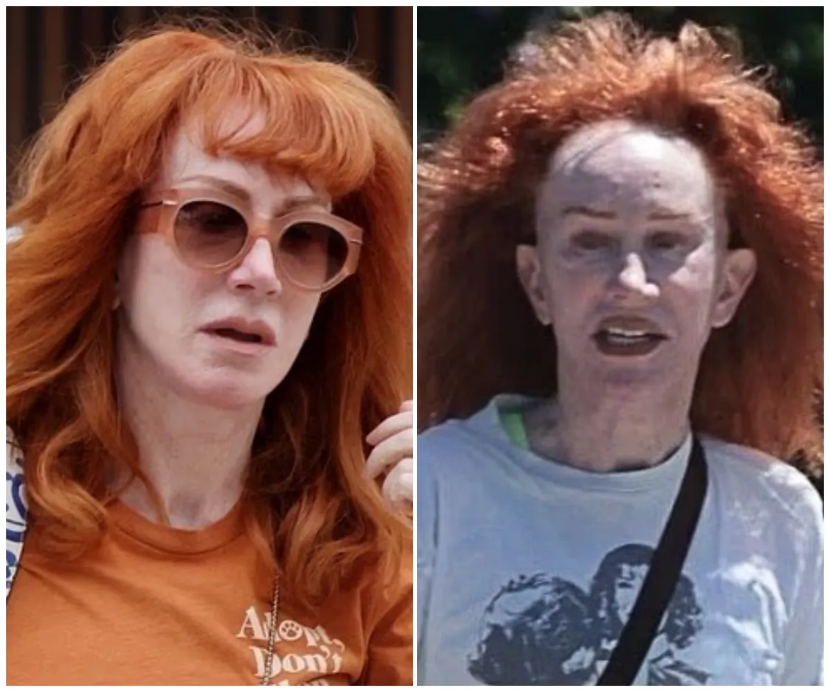 ‘Very taut is very true!’ — Kathy Griffin, 64, debuts astonishingly smooth new face in Malibu after revealing she’s undergone her THIRD facelift — complete with eye lift, chin work and blepharoplasty in painful transformation - suong