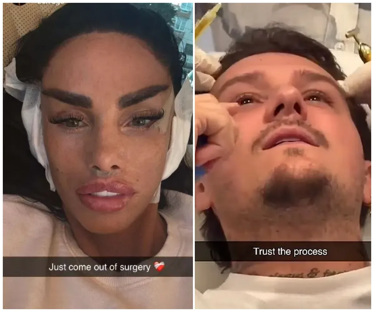 ‘We just turned up!’ — Katie Price reveals MAFS UK boyfriend JJ Slater finally gets ‘hair transplant’ in Turkey after being denied surgery over diabetes… as couple’s unplanned clinic visit ends with shock PRP procedure caught on camera - suong