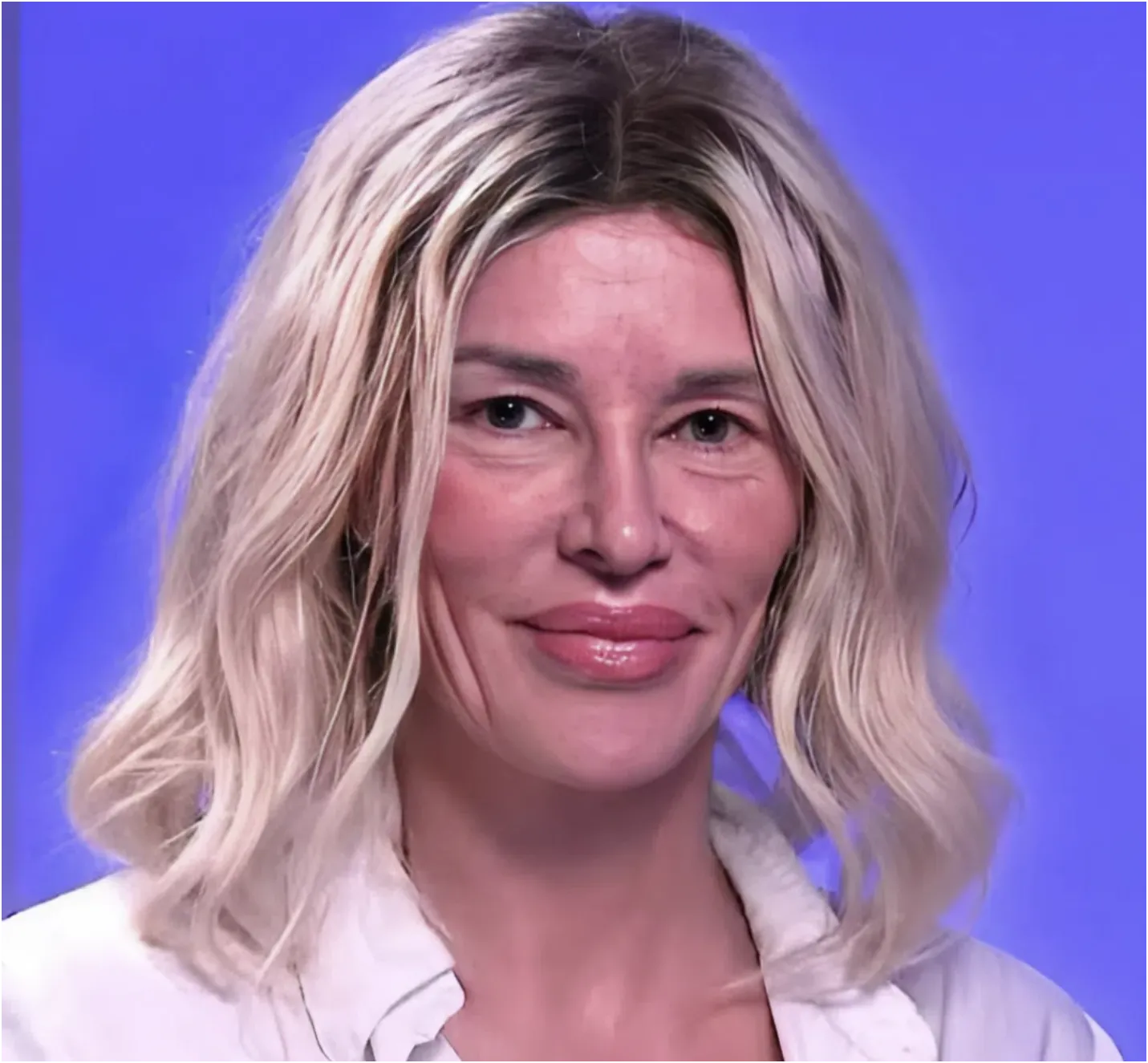 Brandi Glanville Spends Over $100K on 21 Doctors to Treat Mysterious Facial Parasite