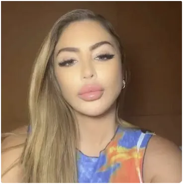 Larsa Pippen Denies Filler Rumors, Claims Allergic Reaction Caused Facial Swelling