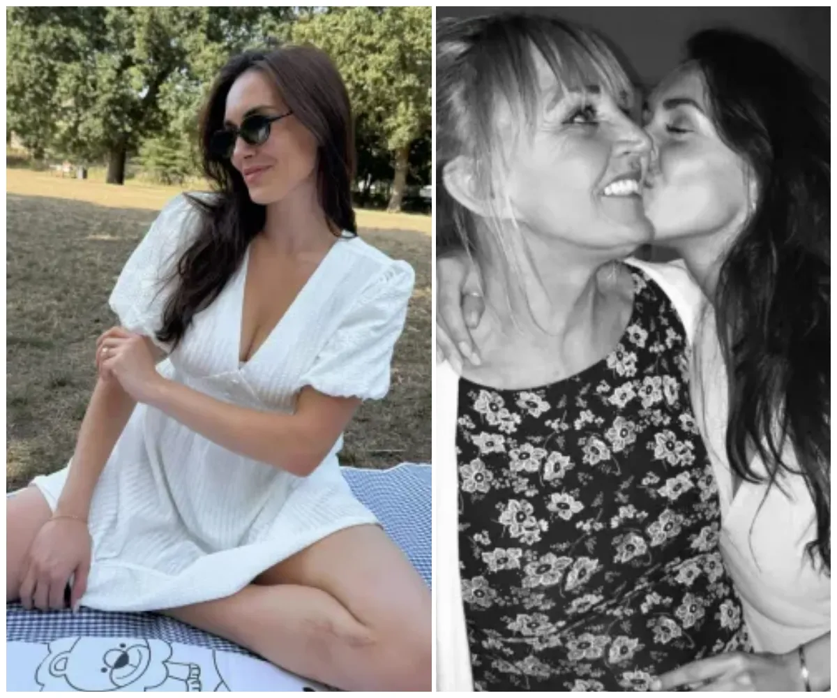 ‘I’m walking...’ — Towie star Clelia Theodorou shows scars from fatal crash for the first time, two years after tragedy that killed her mum and left her in hospital for weeks while pregnant… as she shares message... - suong