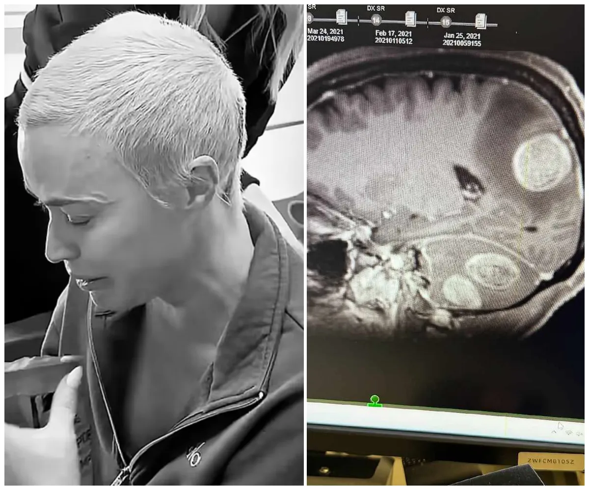 #BreakingNews 💔🙏 Teddi Mellencamp Hit With Another Heartbreaking Update — Please Pray for Her — Details in Comments - suong