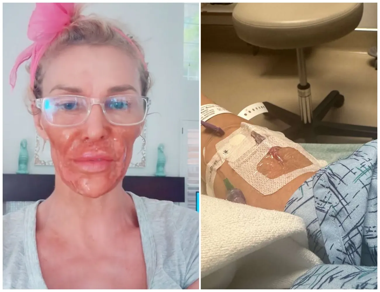 #BreakingNews 💔🙏 Pray for Brandi Glanville — 911 CALLED After Scary Health Crisis — Full Story in Comments - suong