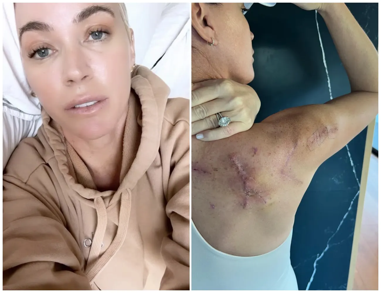 #Breaking UPDATE: TEDDI MELLENCAMP cancer fight takes TRAGIC turn 💔🙏 - suong