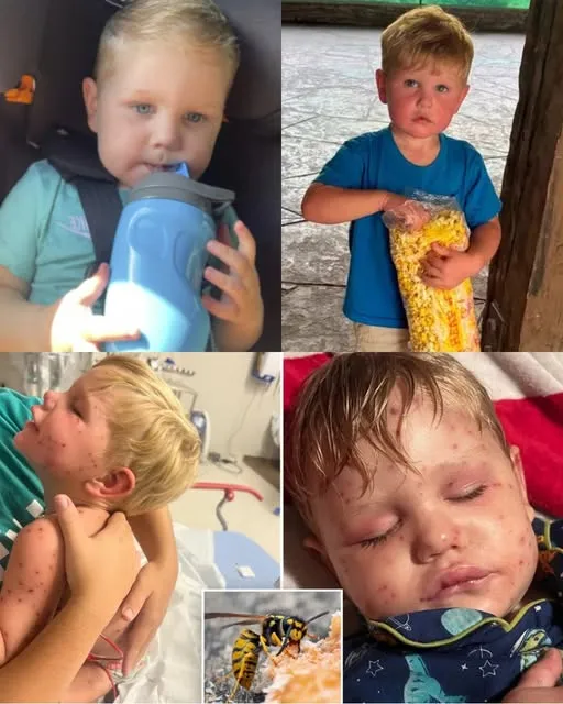 2-year-old Beckham Reed is clinging to life in a Georgia hospital after suffering over 150 yellowjacket stings, an attack that left the toddler unresponsive and requiring life support.