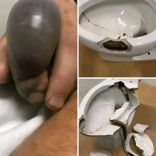 He went to the bathroom without knowing that there was a…