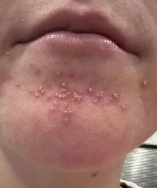 These are the consequences of sleeping with…