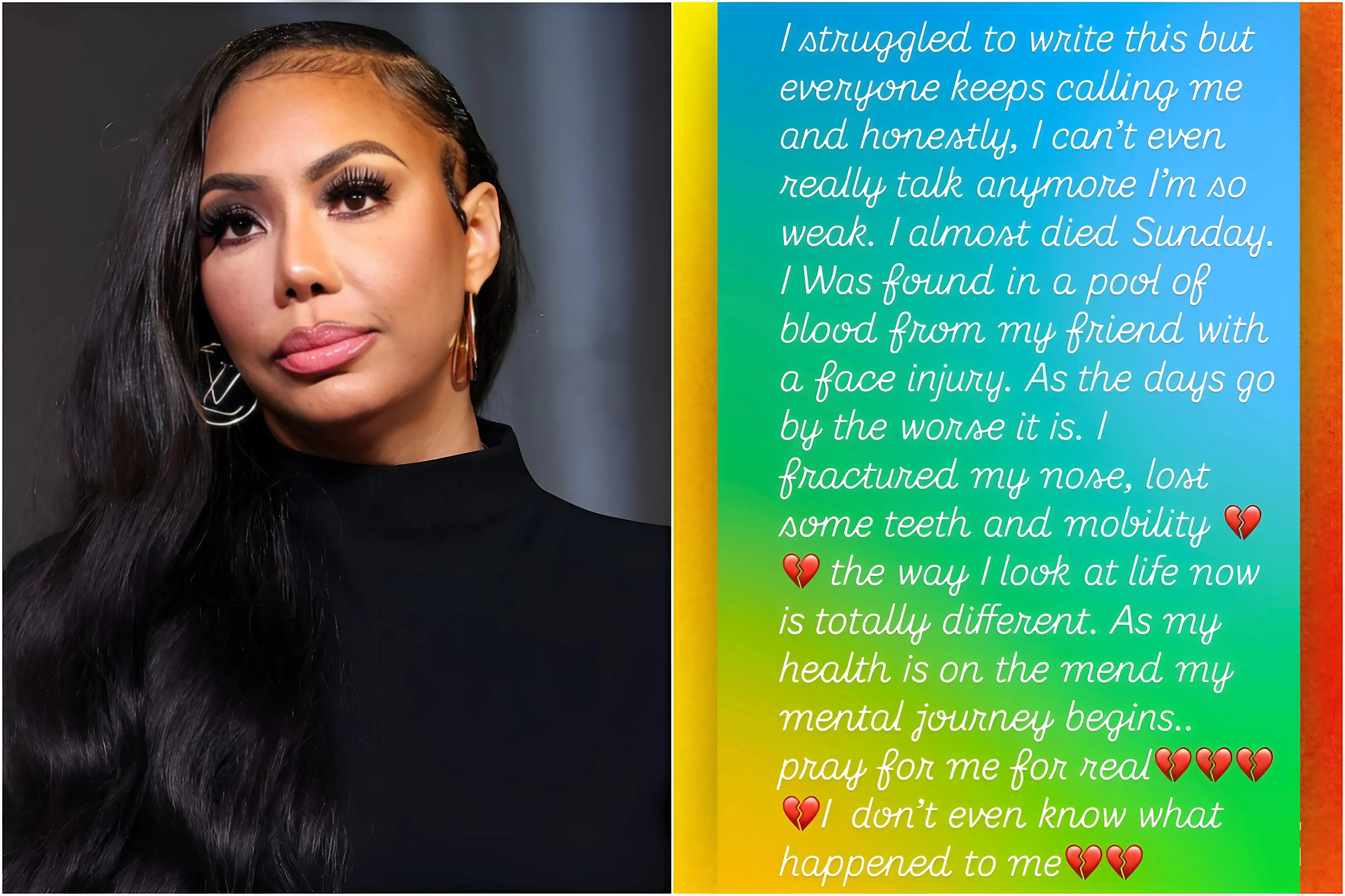Tamar Braxton ‘found in a pool of blood’ with fractured nose, missing teeth after mysterious near-death experience i
