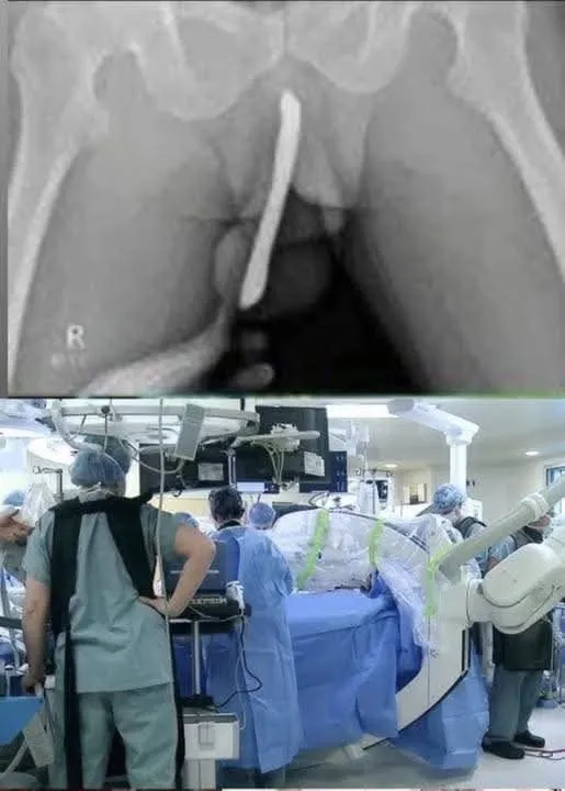 😱Girl was hospitalized for trying one more pen…See more