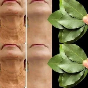Bay Leaf Is 100,000 Times Stronger Than Botox? | Natural Wrinkle Eraser Even at Age 70!