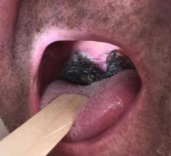 HT10. These are the consequences of sleeping with…see more