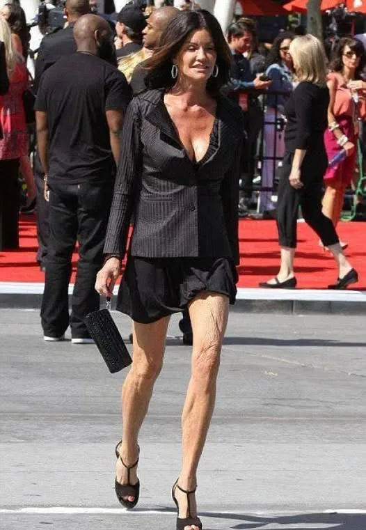 «No retouching, just reality!» The following scandalous paparazzi photos of show business stars have been surfacing the network