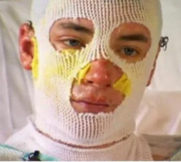 Heroic Uncle Runs Into Burning House To Save Niece And Nephews