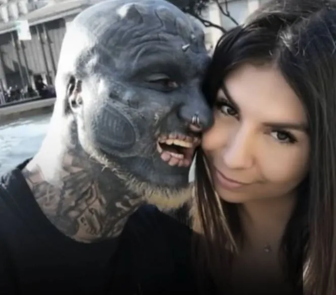 He Was Dubbed As The ‘World’s Most Modified Man’ But Wait Till You See How He Looked Like Before